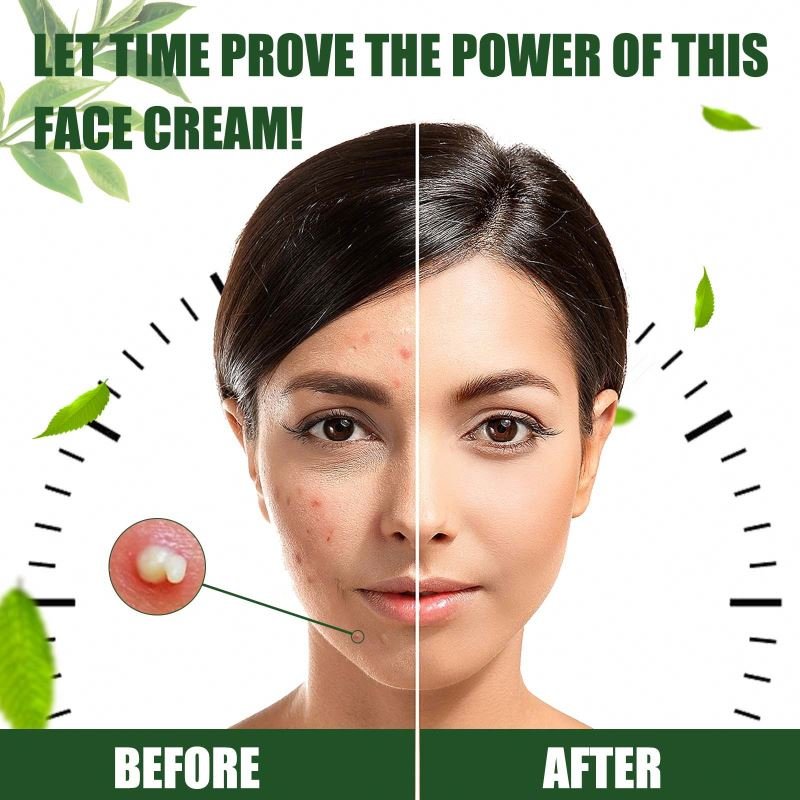 Pearl Beauty Nourishing and Whitening Day Adults Female Skin Lightening Golden 3 Years Face Moisturizer Cream