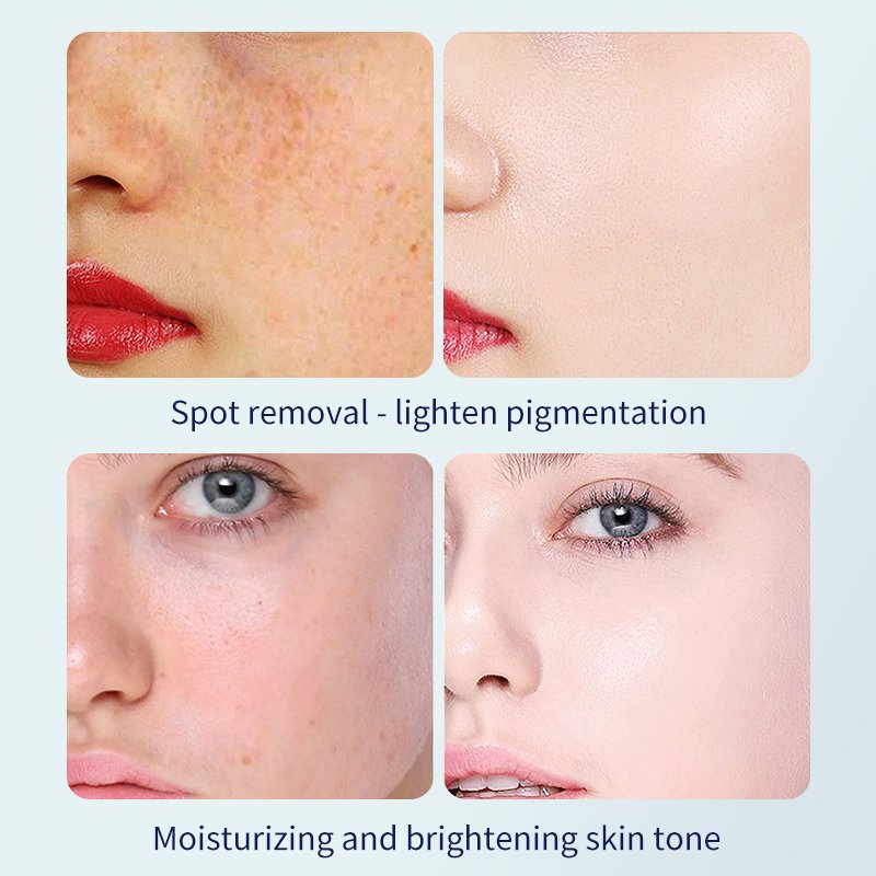 Korean Cosmetic Super 377 Skin Moisturizing And Firming Cream 377VC Lotion Anti Aging Whitening Face Cream & Lotion