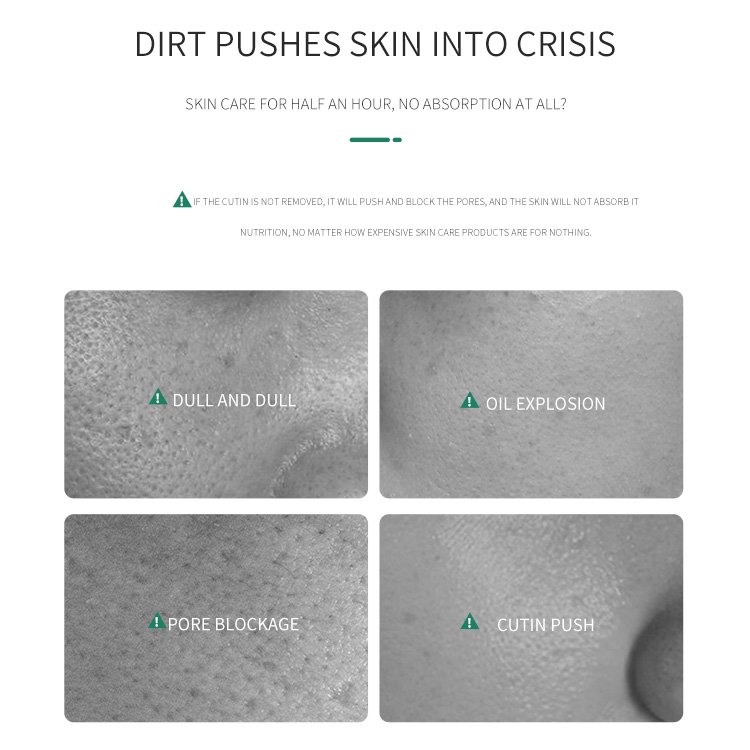 OEM YDEWLY private label Yeast Bamboo Charcoal Ice Crystal Gel repair dry skin moistureskin care face cream