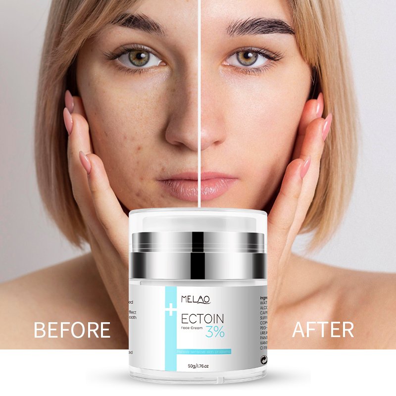 OEM Private Label Skincare 3%Ectoin Face Cream Nourishing And Hydrating And Anti Aging Ectoin Face Cream
