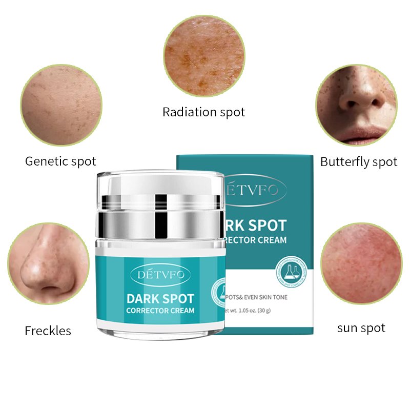 Private Label Face Black Freckle Acne Fade Dark Spot Removing Corrector Whitening Cream