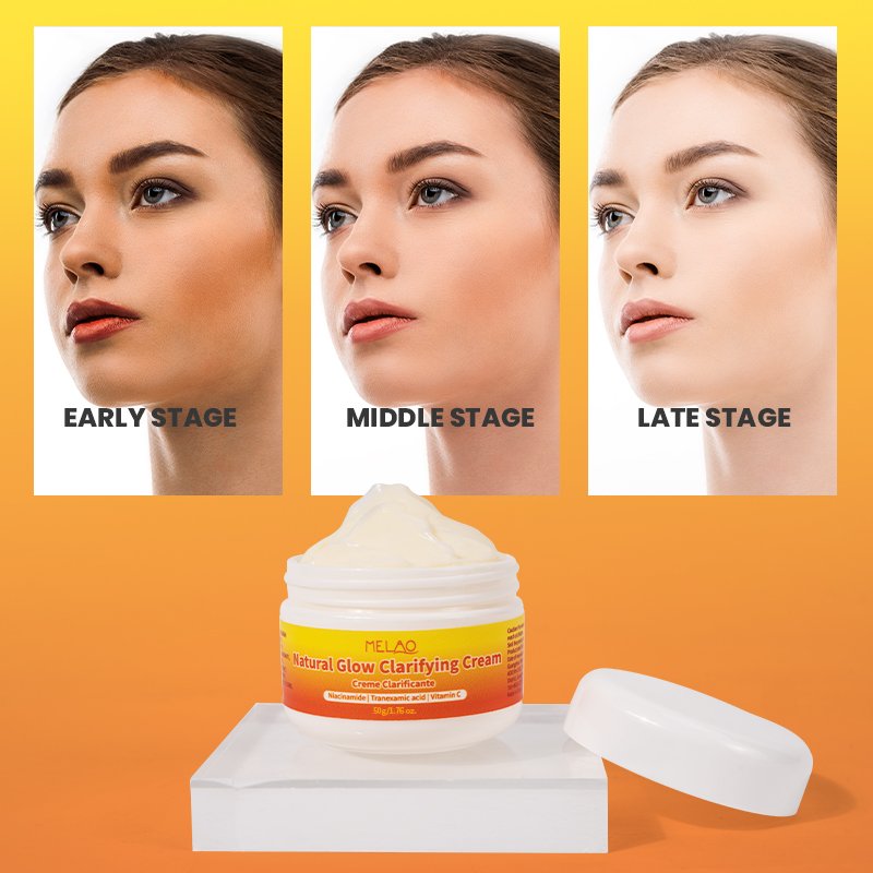 OEM ODM Face Brightenes Cream Black Skins Spot Face Cream For Glowing Skin