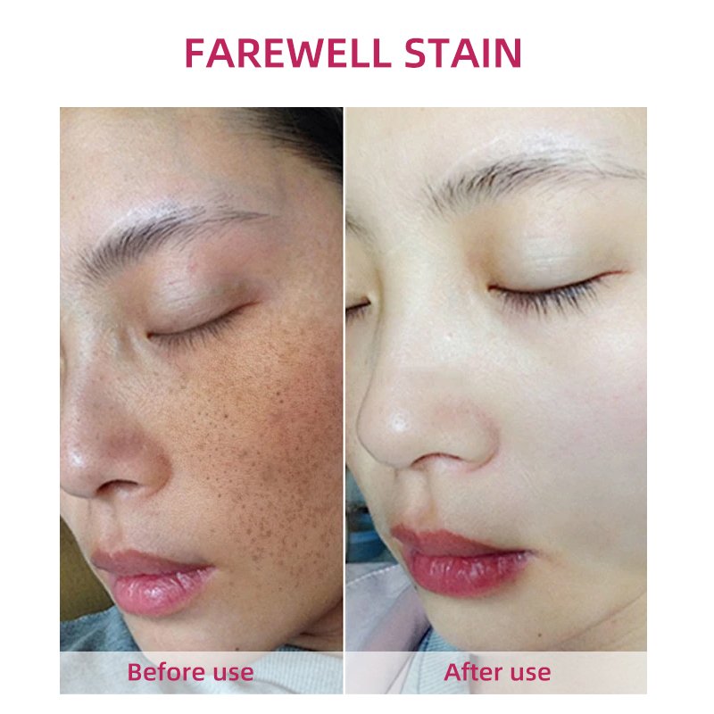 OEM Natural Organic Extract Cream Aloe Tocopherol Acetate Niacinamide Moisturizing Brightening Anti Wrinkle Skin Care Face Cream