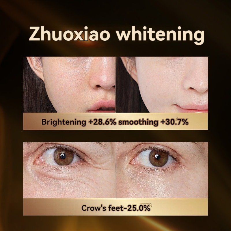 Manufacturer'S Hot Selling Sodium Hyaluronate Water Locking Face Cream Arbutin Whitening And Freckle Removing Face Cream
