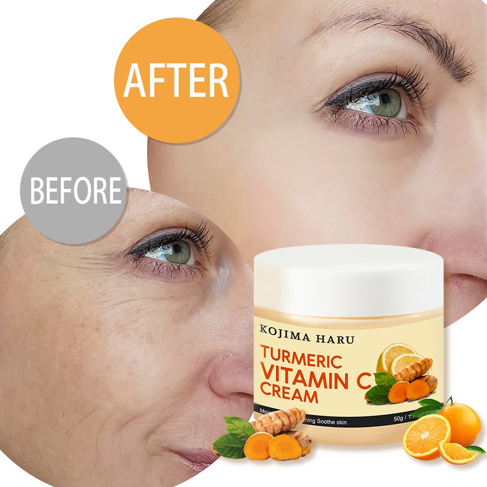 OEM New Face Cream Private Label Face Acne Cream Gutaderme Whitening Skin Turmeric Vitamin C Cream For Men & Women