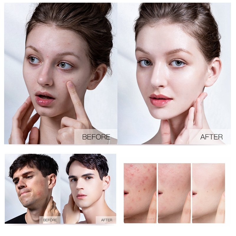 Private Label Best Face Cream For Fair Skin Whiting Cream For Face And Body