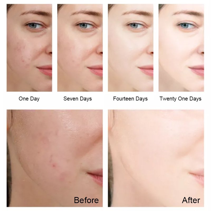 Skin Care Whitening Moisturizing lightening anti-wrinkle beauty face cream