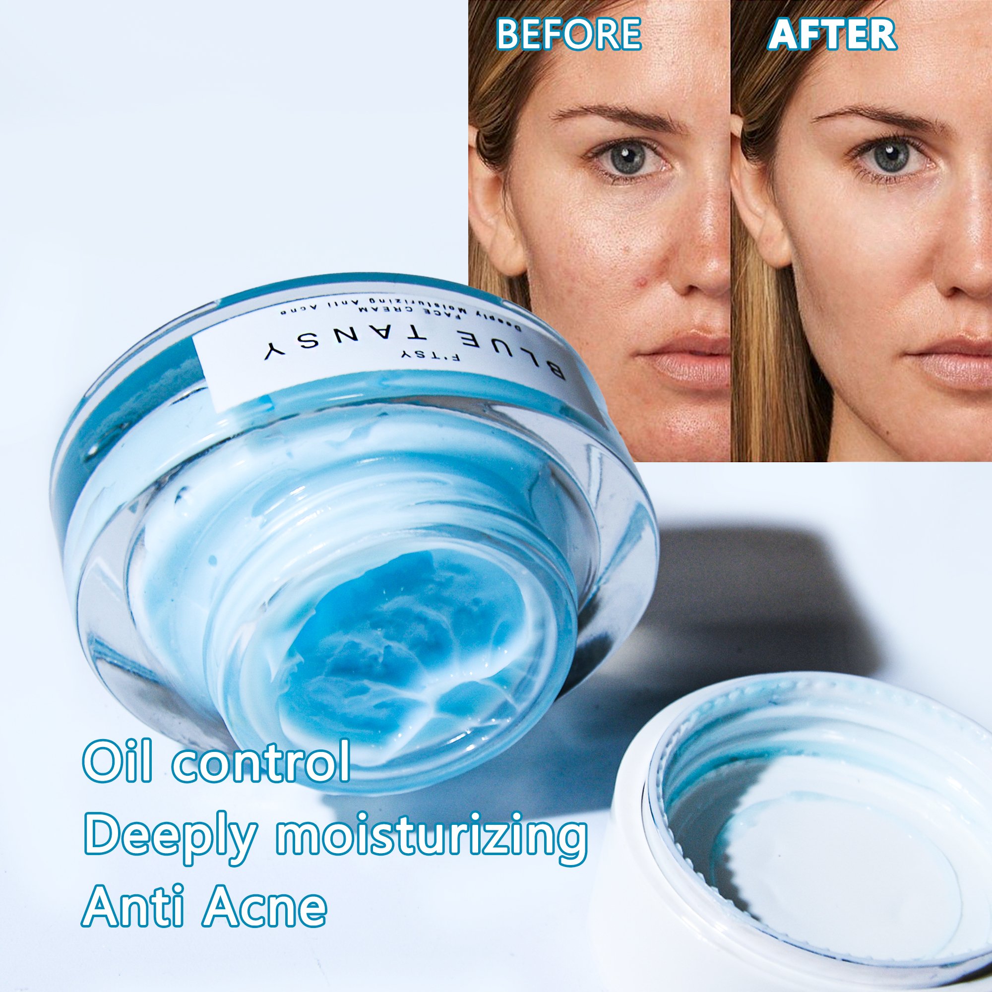 Custom Logo Manufacturer Acne Treatment Skin Care Calming Moisturizing Repairing Reduce Redness Renew Blue Tansy Face Cream