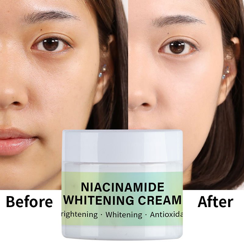 OEM/ODM Anti-aging Moisturizing Whitening Niacinamide Whitening Face Cream For Face Women Men