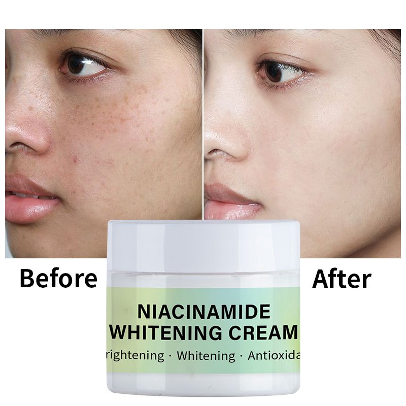 OEM/ODM Anti-aging Moisturizing Whitening Niacinamide Whitening Face Cream For Face Women Men