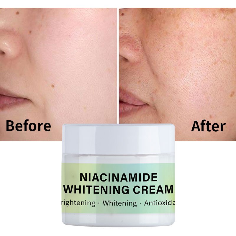 OEM/ODM Anti-aging Moisturizing Whitening Niacinamide Whitening Face Cream For Face Women Men