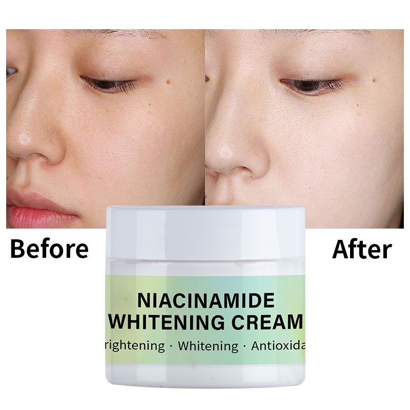 OEM/ODM Anti-aging Moisturizing Whitening Niacinamide Whitening Face Cream For Face Women Men