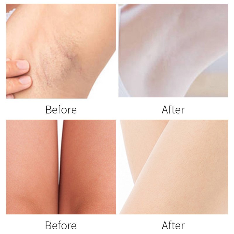 Natural Organic Armpit Underarm Body Black Skin Bleaching Cream Skin Whitening Face Cream For Dark Skin