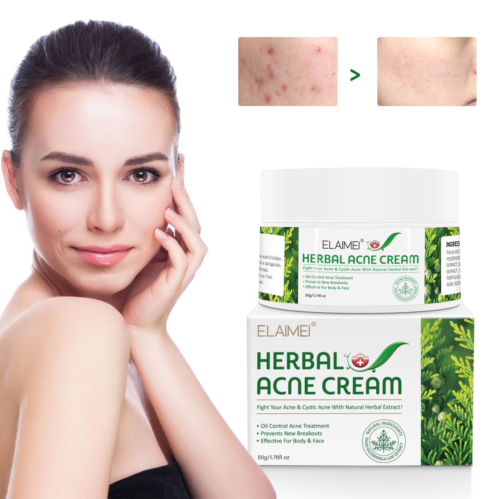 Custom Logo Tea Tree Oil Face Cream Crema Hidratante Skin Care Moisturizing Scars Remove Cream Creme Visage Natural Acne Cream