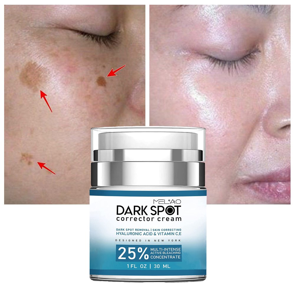 Private Label Korean Dark Spot Removal Cream Anti Aging Whitening Face Cream For Dark Spot Removing