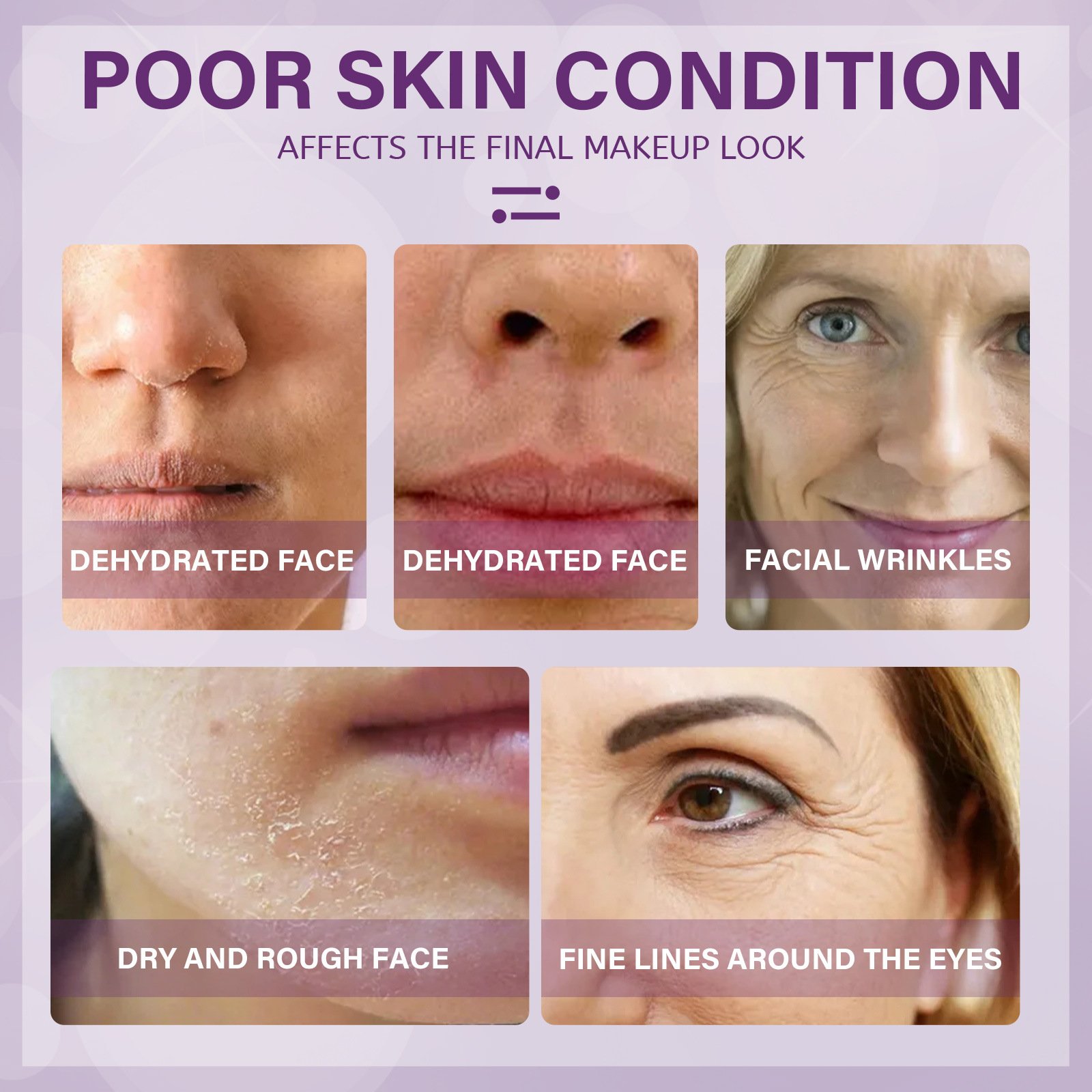 Wholesale Improving Dry Skin Care Face Cream Tightening Skin Reducing Wrinkles Face Cream Moisturiser