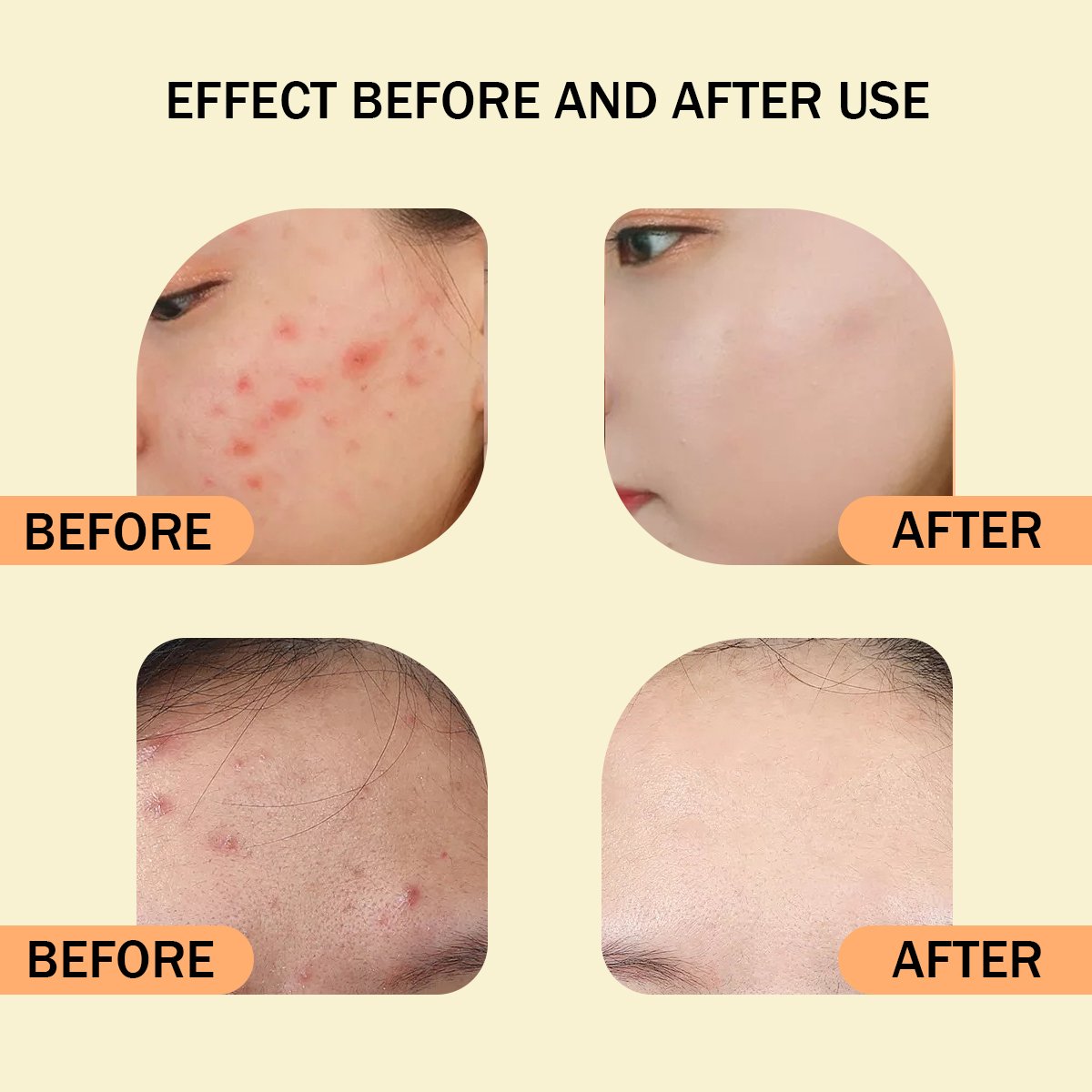 Best Face Glow Cream with Sophora Flavescens Natural Ingredients for Radiant Skin