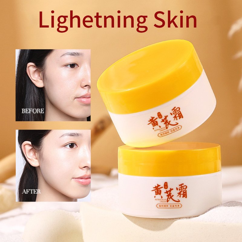 TWG Acne Mark Removal Face Cream & Lotion Skin Brightening Lightening Spot Beauty Salon Astragalus Whitening Face Cream