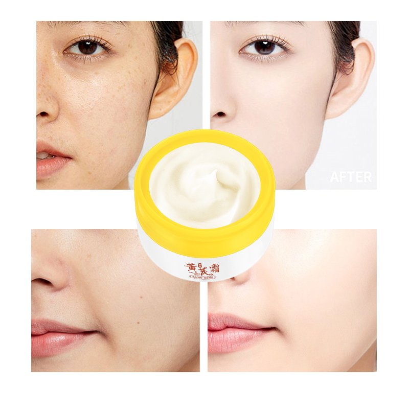 TWG Acne Mark Removal Face Cream & Lotion Skin Brightening Lightening Spot Beauty Salon Astragalus Whitening Face Cream