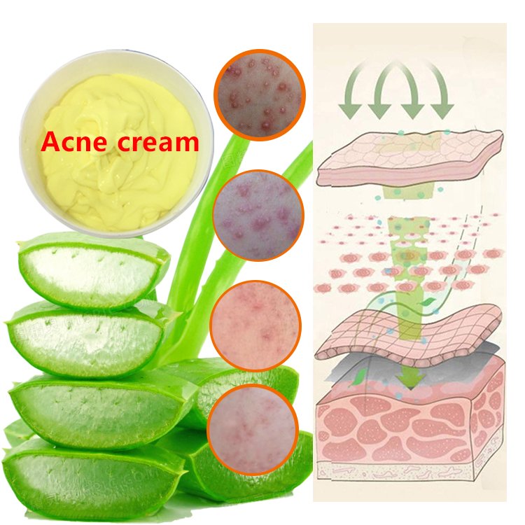 Strong Result Acne Spot Remover Cream Private Label OEM Face Cream Ready To Use Whitening Cream For Skin Care