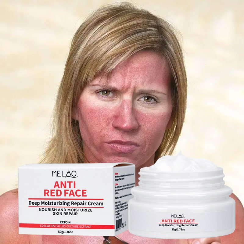 OEM ODM Skin Calming Face Cream Soothing Sensitive Skin Care Redness Relief Cream Dry Skin Winter Face Cream For Rosacea