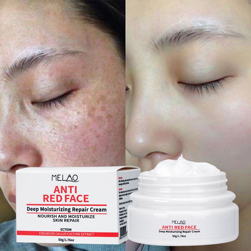 OEM ODM Skin Calming Face Cream Soothing Sensitive Skin Care Redness Relief Cream Dry Skin Winter Face Cream For Rosacea