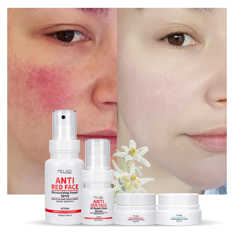OEM ODM Skin Calming Face Cream Soothing Sensitive Skin Care Redness Relief Cream Dry Skin Winter Face Cream For Rosacea