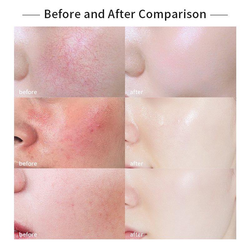 OEM ODM Skin Calming Face Cream Soothing Sensitive Skin Care Redness Relief Cream Dry Skin Winter Face Cream For Rosacea
