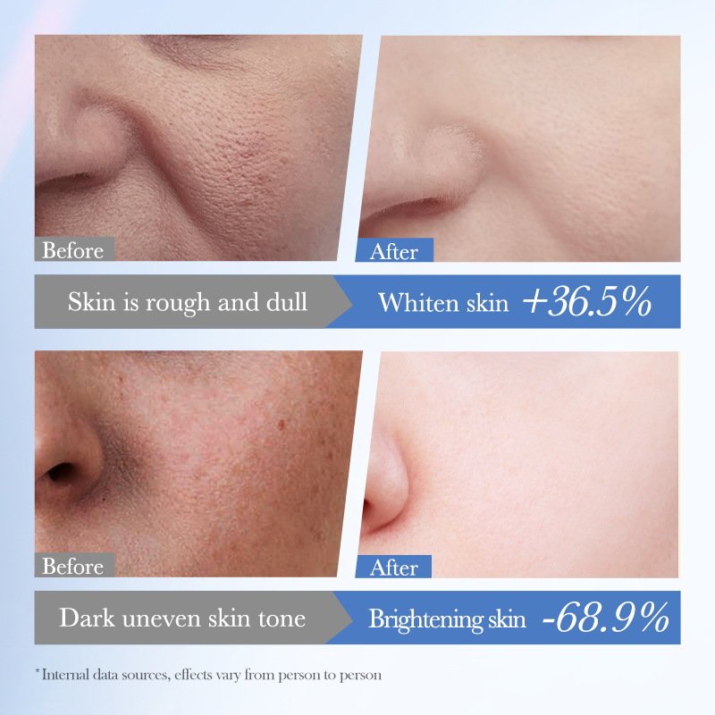 White rice nicotinamide skin brightening delicate anti wrinkle skin repairing face cream