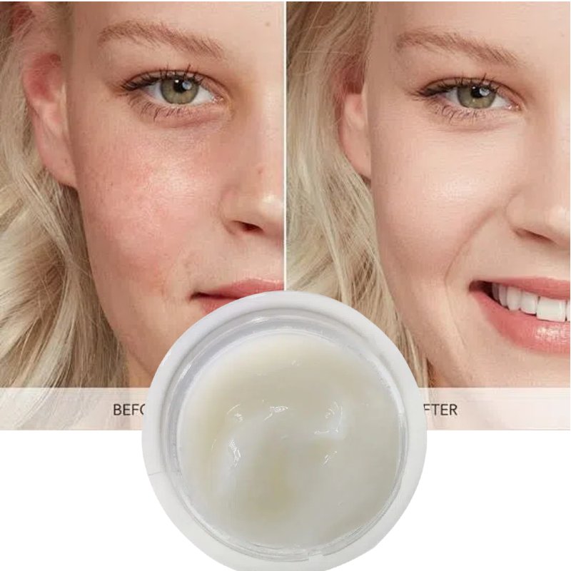 OEM Ceramide Mussel Soft Cream Repair Soothe Sensitive And Redness Skin Anti-oxidant Squaline Mussel Protein Repair Face Cream