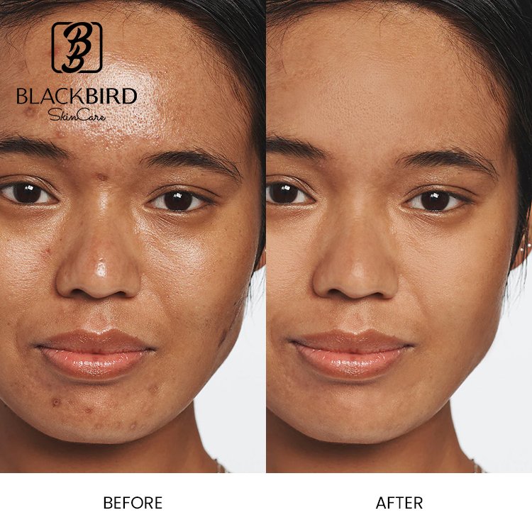 Private Label 5% 10% Azelaic Acid Brightening Facial Cream Lightening Whitening Moisturizing Anti Aging Beauty Face Cream Lotion