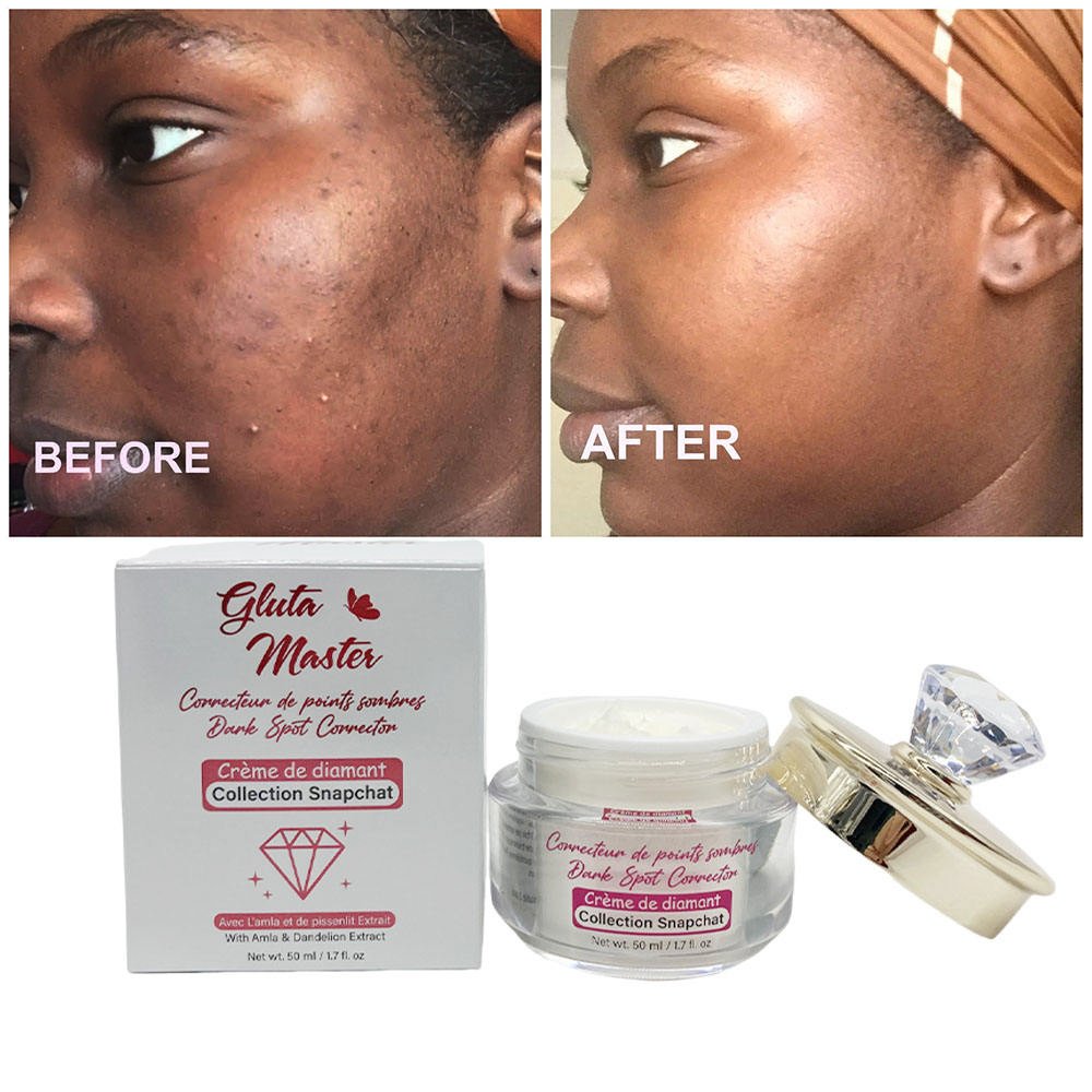 Gluta Master Diamond Glow Dark Spot Corrector Face Cream with Glutathion Super Lightening Black Skin Shine Beauty Cream