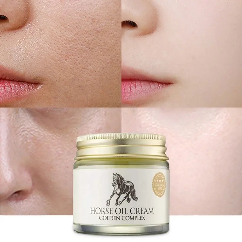 Private Label Best Skin Care Natural Anti Pimple Removal Treatment Whitening Repair Anti Acne Face Cream