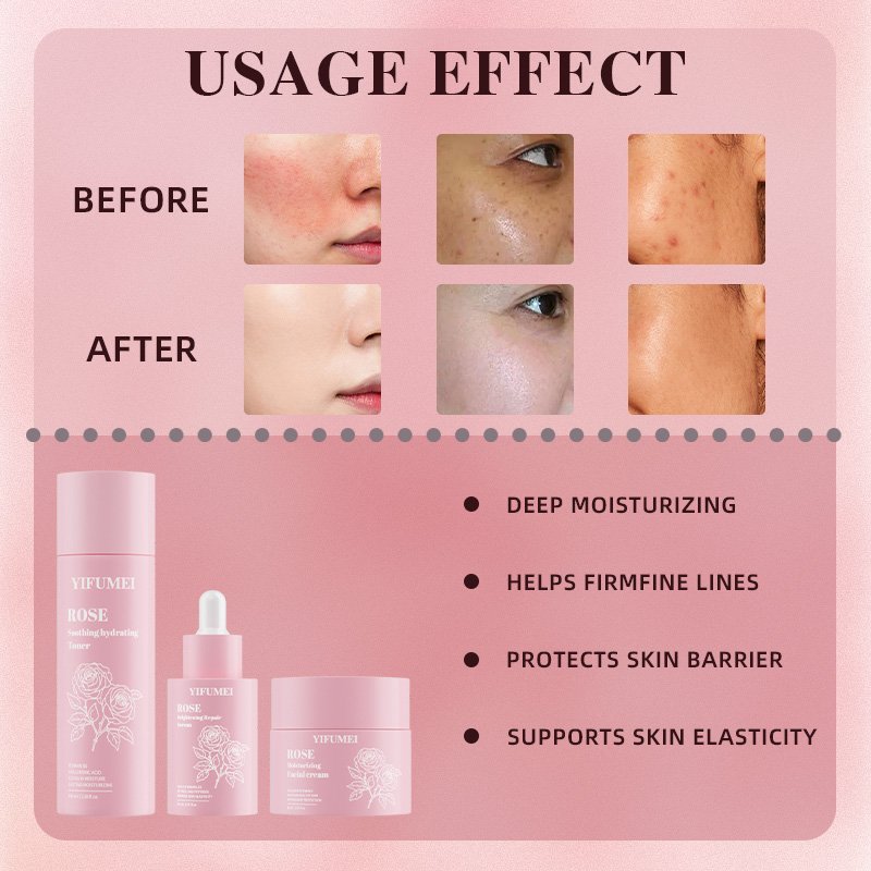 Private Label Skincare Rose Toner Retinol Cream Anti Aging Wrinkles Brightening Whitening Kit Face Skin Care Set