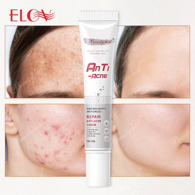 Skin Care Anti Acne Face Cream Natural Organic Private Label Most Effective Pimple Acne Removal Deep Repairing Face Cream