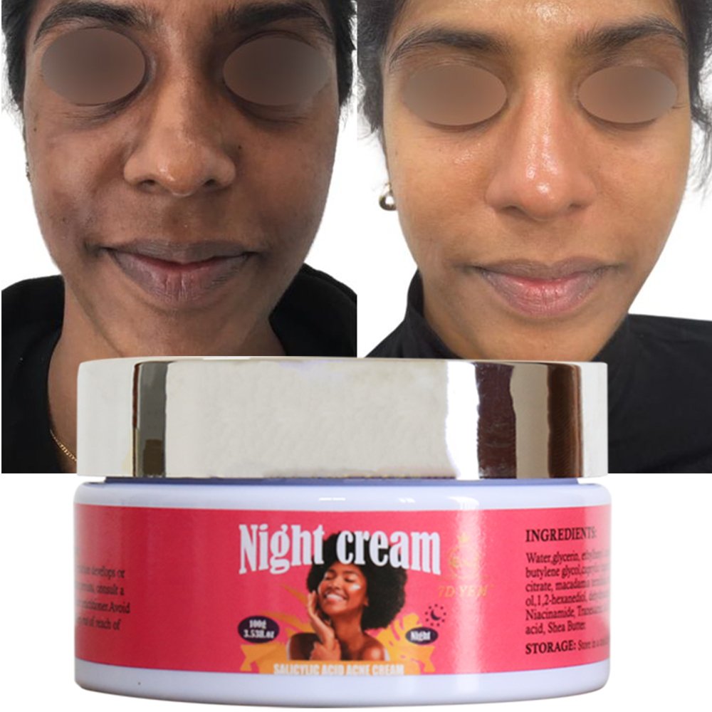 High quality 7 days whitening night cream Reducing wrinkles anti aging whitening brightening face skin whitening night cream