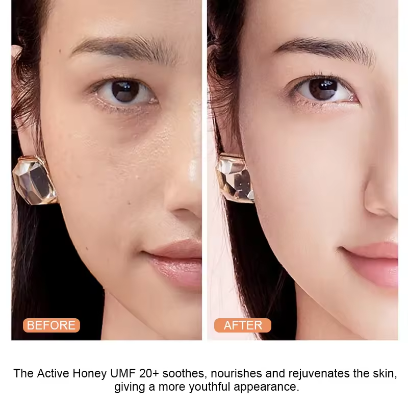 Private Label Natural Bee Venom Treatment Cream Manuka Honey Moisturizing Face Cream Wholesale Bee Venom Cream