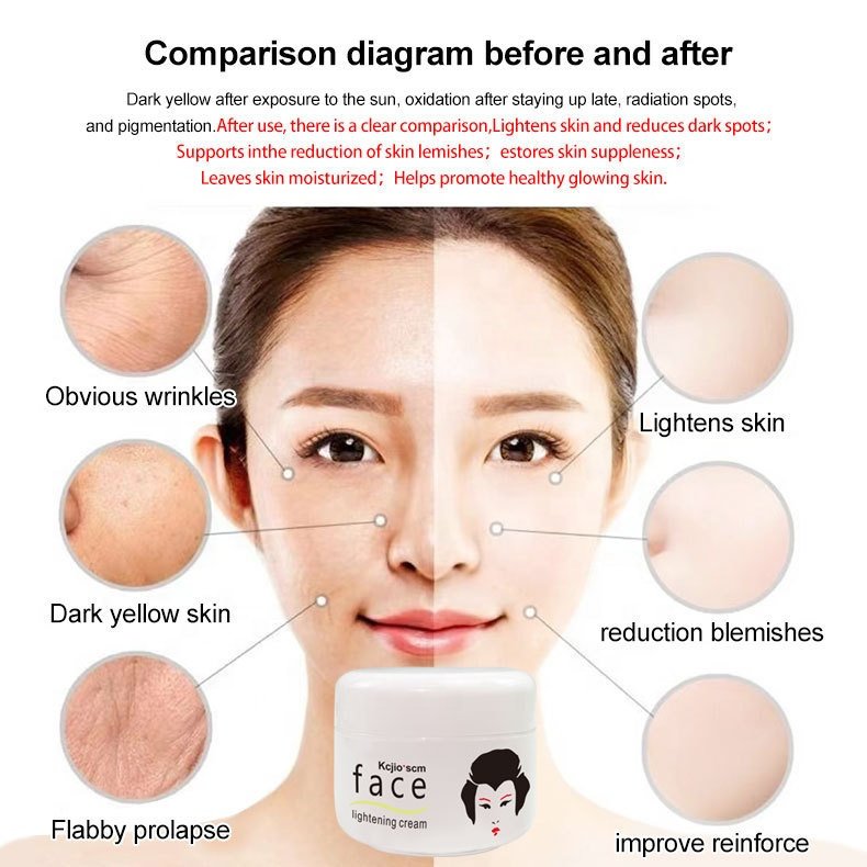 WHOLESALE 50g Kojic FACE lightening cream
