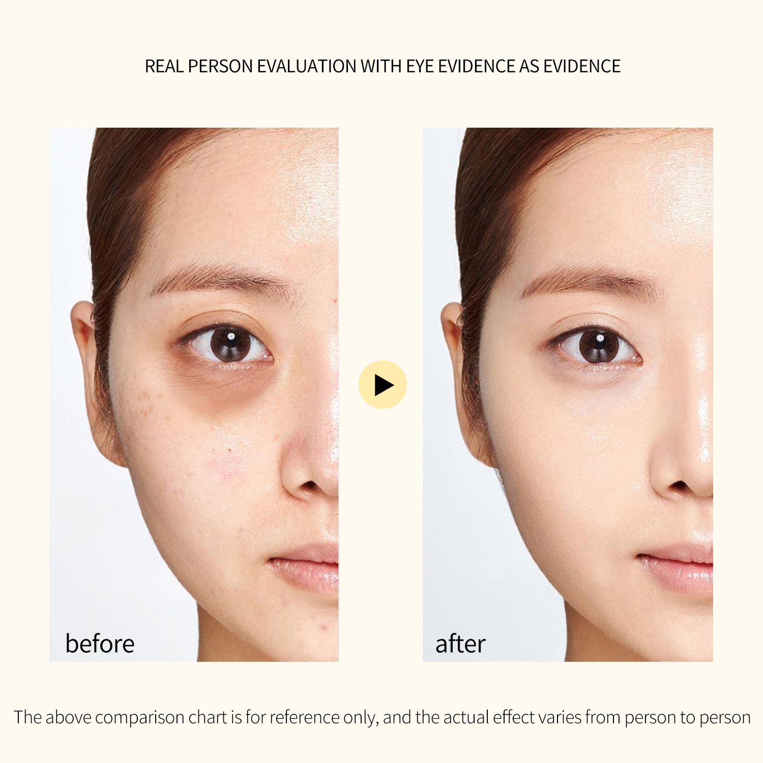 Best Anti-Wrinkle Anti-Aging Retinol Face Cream for Women Factory Wholesale Niacinamide as Main Ingredient for Skin Care