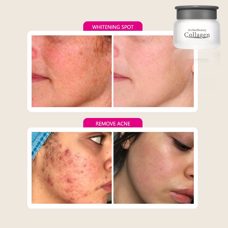 Best Snail Collagen Face Cream For Fair Skin Whitening Beauty Face Cream For Men Women Glowing Skin In Saudi Arabia Facial Care