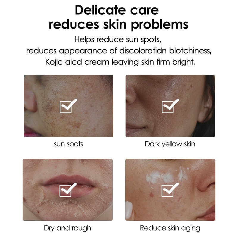Private label skin care product greenlem whitening natural kojic anti aging acid skincare cream facial face cream
