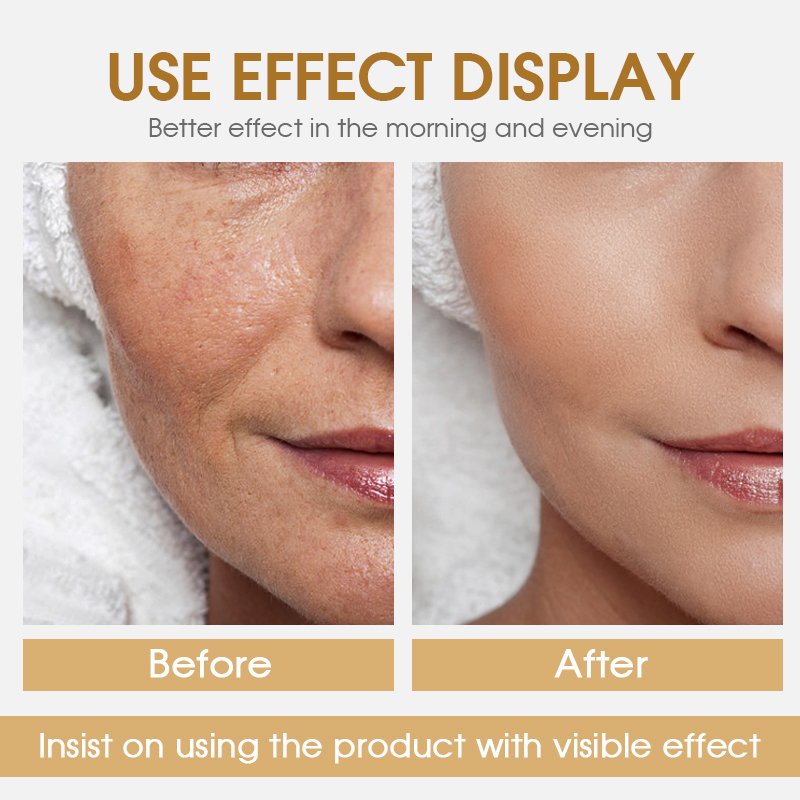 Guangzhou Face Cream Sulfate-Free Moisturizer Lightening and Organic Vitamin C Snail Mucin Anti aging Face Cream