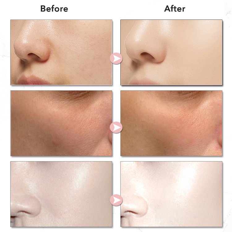Private Label Face Anti Acne Wrinkle White Whitening Day Moisturizer Niacinamide Cream