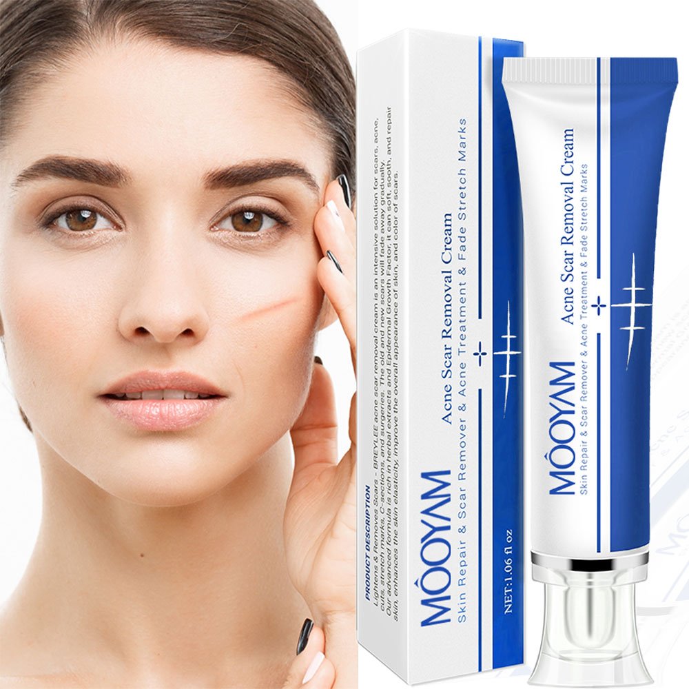 Strong Effective Acne Scar Removal Cream Pimples Stretch Marks Remove Face Gel Tummy Tuck Tightening Stretch Mark Removal Cream