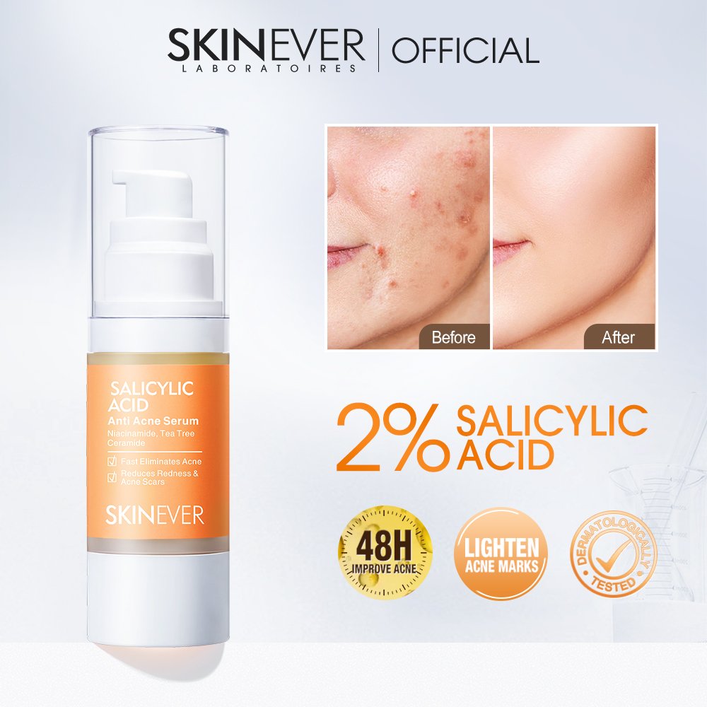 SKINEVER Fast Acting Anti-Acne Serum Salicylic Acid Liquid Face Serum Acne Reduction Anti-Wrinkle Scar Elimination Herbal
