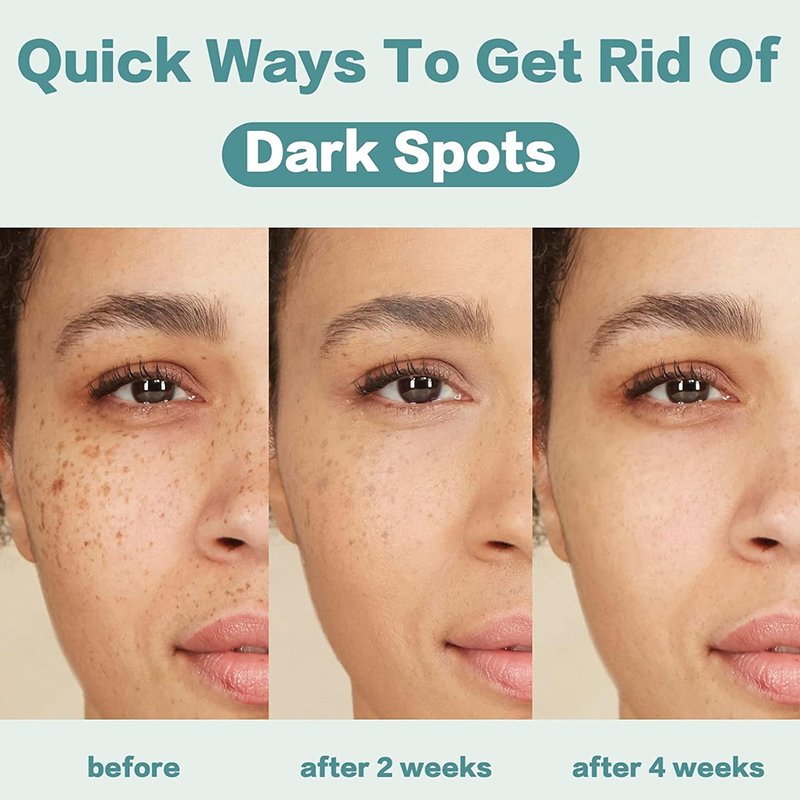 Face Cream Lightening Dark Spots Remover Skin Care Strong Whitening Cream Best Face Skin Whitening Products for Black Skin
