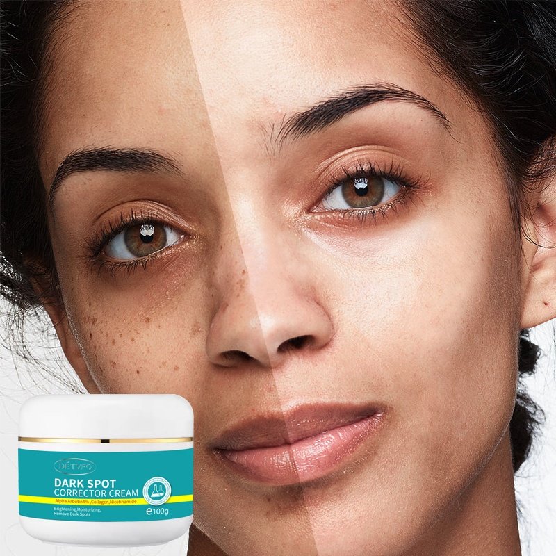 Quick skin bleaching lotion dark spot corrector remover whitening face cream for glowing skin