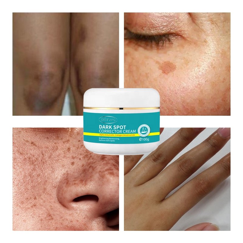 Quick skin bleaching lotion dark spot corrector remover whitening face cream for glowing skin