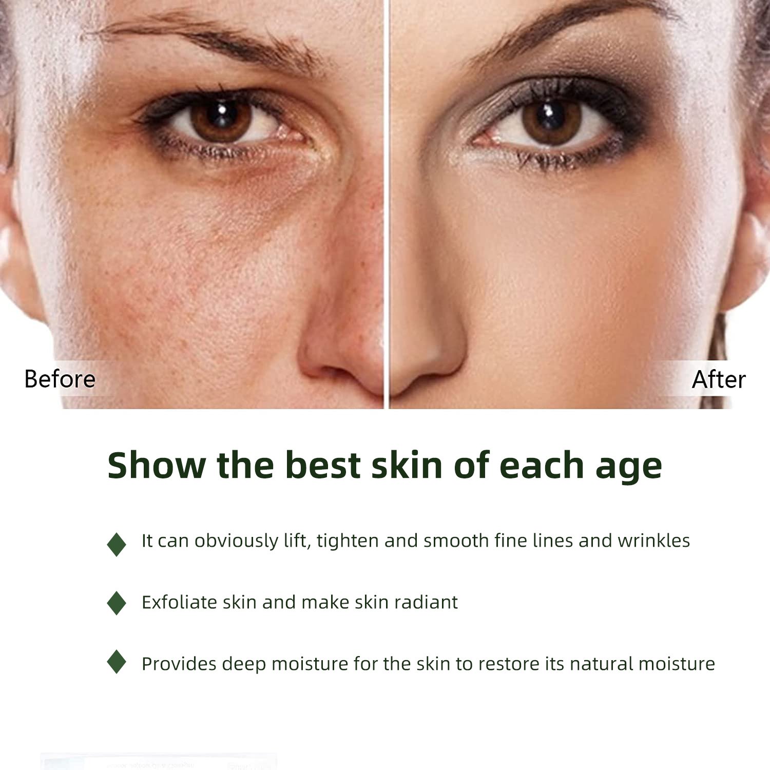Anti Aging Skincare Kit Facial Set Nourish Face Cream & Lotion Deep Moisturizing Squalane Skin Care Set(new)