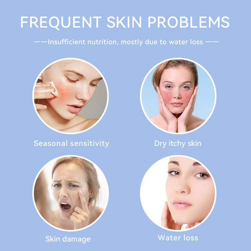Enjoy Skin Hyaluronic Acid Moisturizer Face Cream Moisturizing Smooth Soft Hydrate Anti Wrinkle Face Cream With Vitamin C
